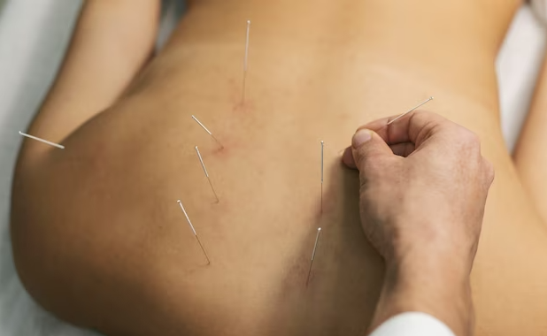 acupuncture clinic
